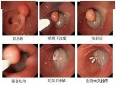 南寧胃腸科醫院排名