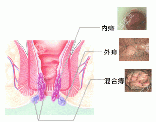 南寧肛腸醫院