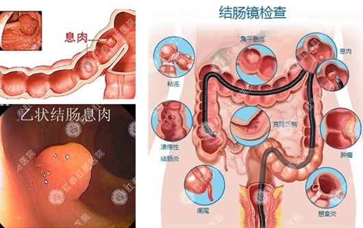 南寧哪家醫院看胃病治療比較好