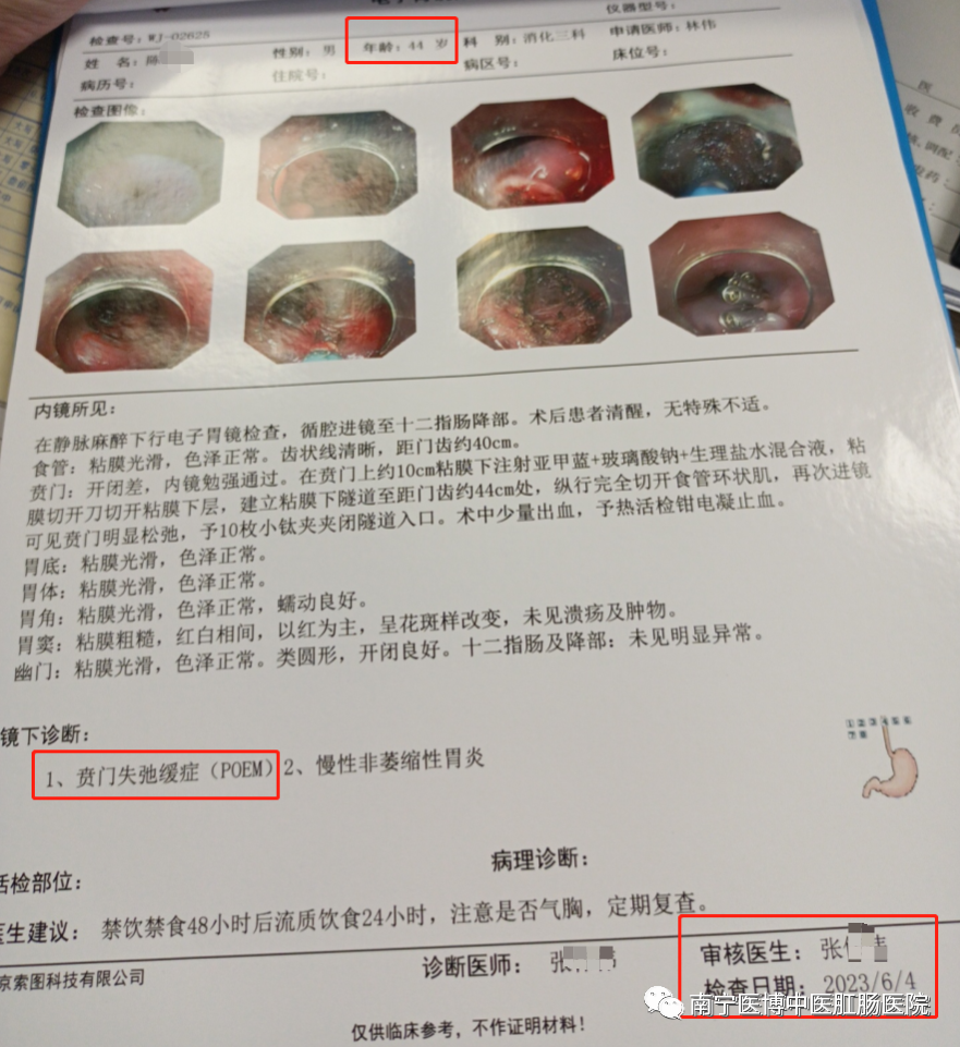 【新技術(shù)】南寧醫博醫院成功開(kāi)展首例賁門(mén)失弛緩癥poem手術(shù)